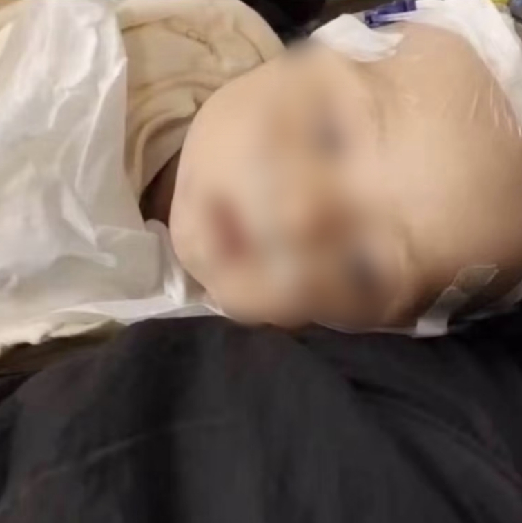 四川6月齡男嬰確診心衰、重癥肺炎：治療缺錢 母親發(fā)起求助(圖2)